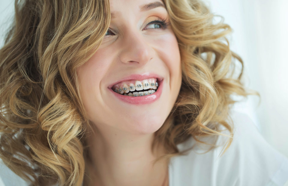 orthodontics for adults